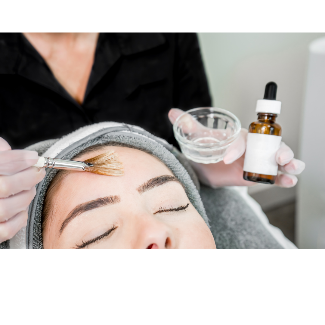 What is a chemical peel and why should I get one?